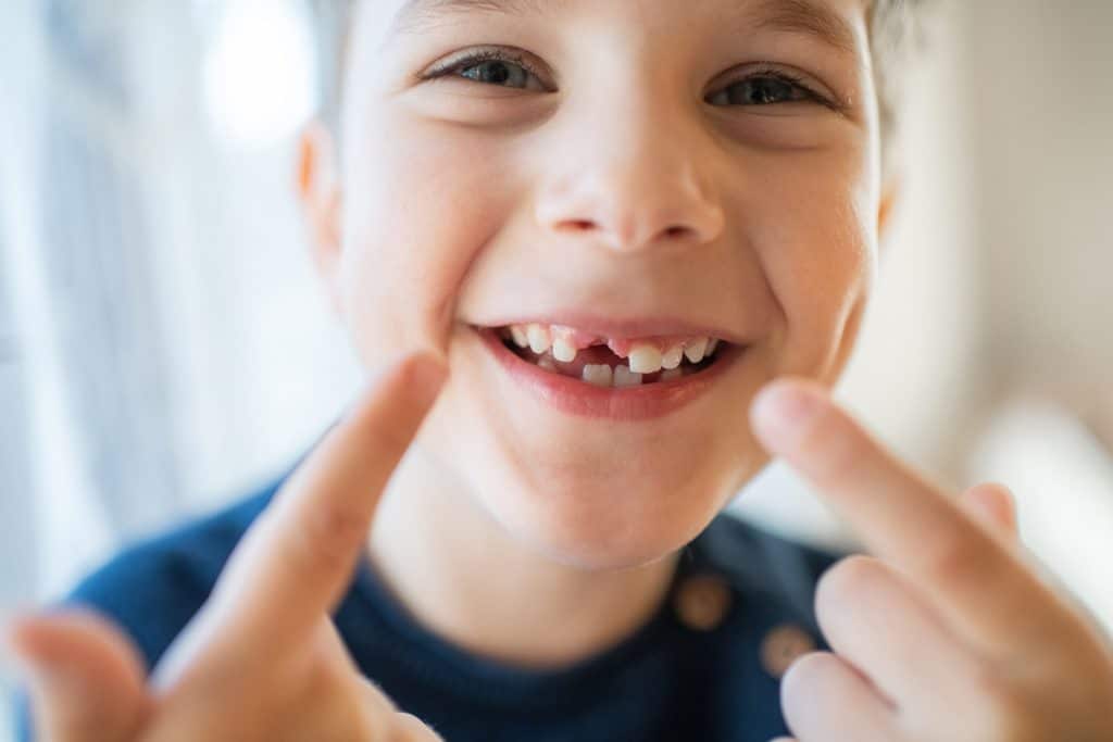 Losing Baby Teeth: When Do Kids Lose Teeth and What to Expect